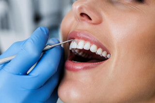 Bleeding Gums Treatment in Chessington