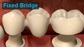 Bridges 0 Bridges