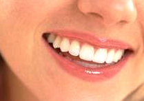 Tooth Whitening