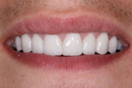 Cosmetic Dentistry