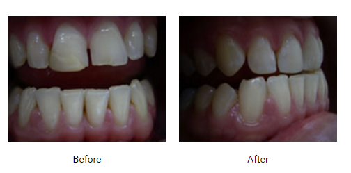 Cosmetic Dentistry