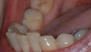 Cosmetic Dentistry