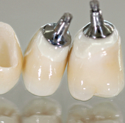 Dental Implants