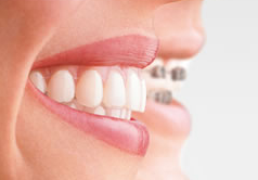 Gum Disease 0 Gum Disease