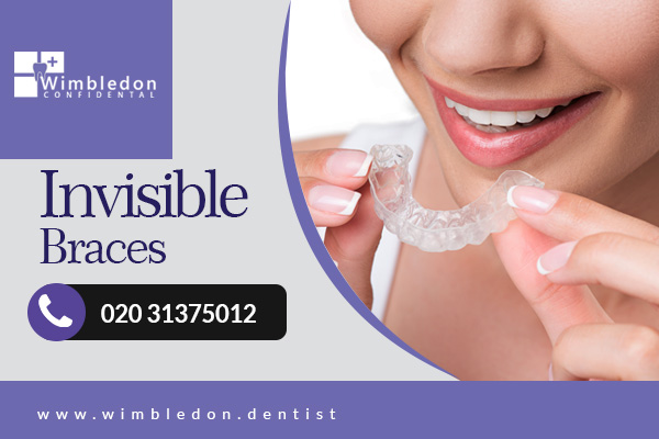 Invisible Braces