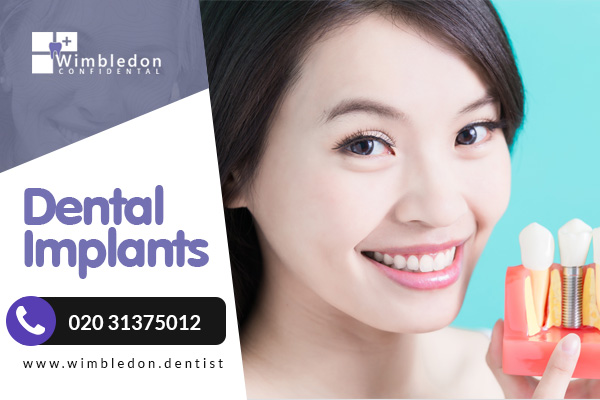 Dental Implants Treatment