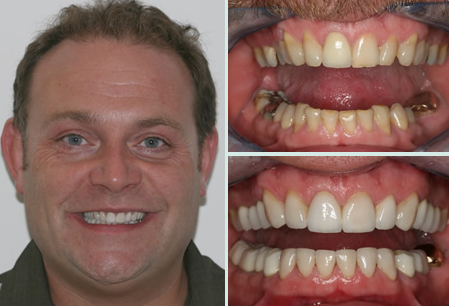 Cosmetic Dentistry