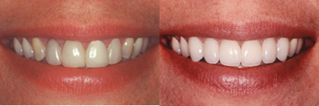 Cosmetic Dentistry