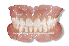 Common Denture Problems