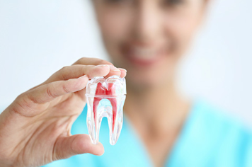 Root Canal Treatment