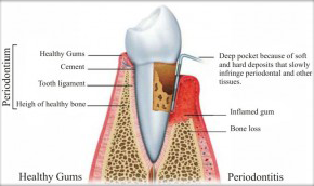 Periodontics