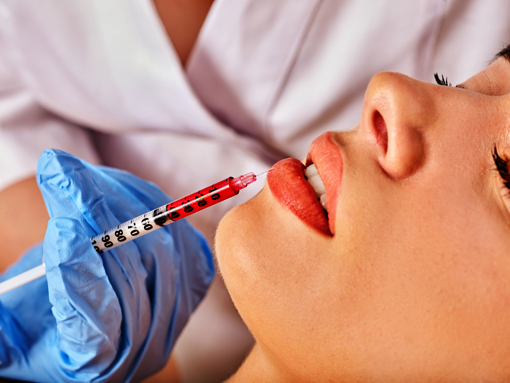 Dermal Fillers