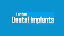 Dental Implants London